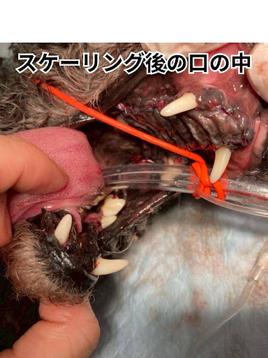 スケーリング後の口の中