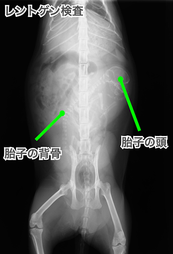 レントゲン検査の胎子
