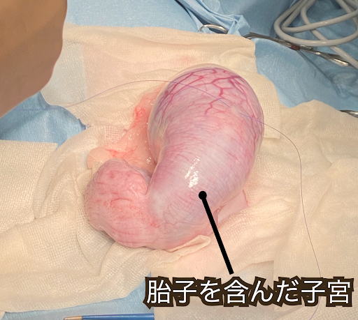 胎子を含んだ子宮