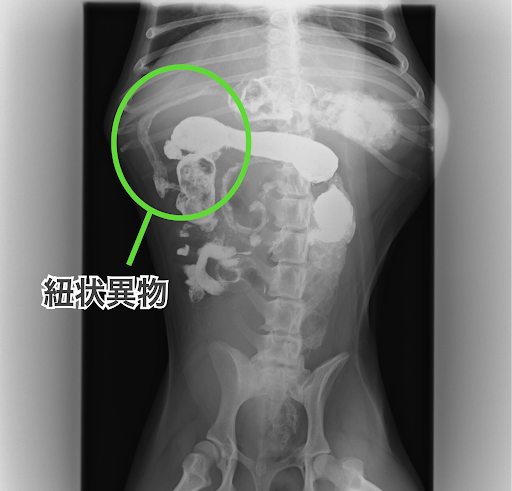 紐状異物が見えるレントゲン画像