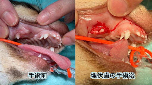埋伏歯の手術後の画像