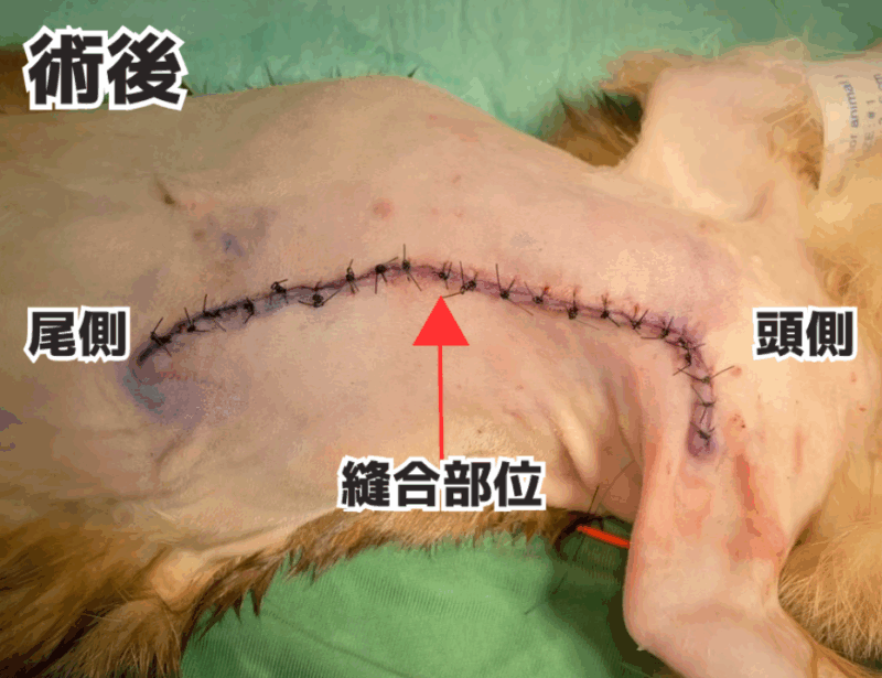 皮下膿瘍の手術後の様子